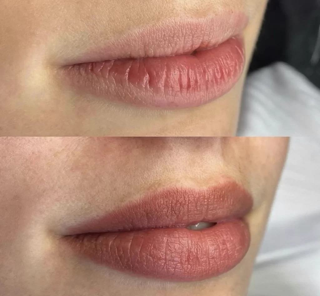 lip tattoo before after