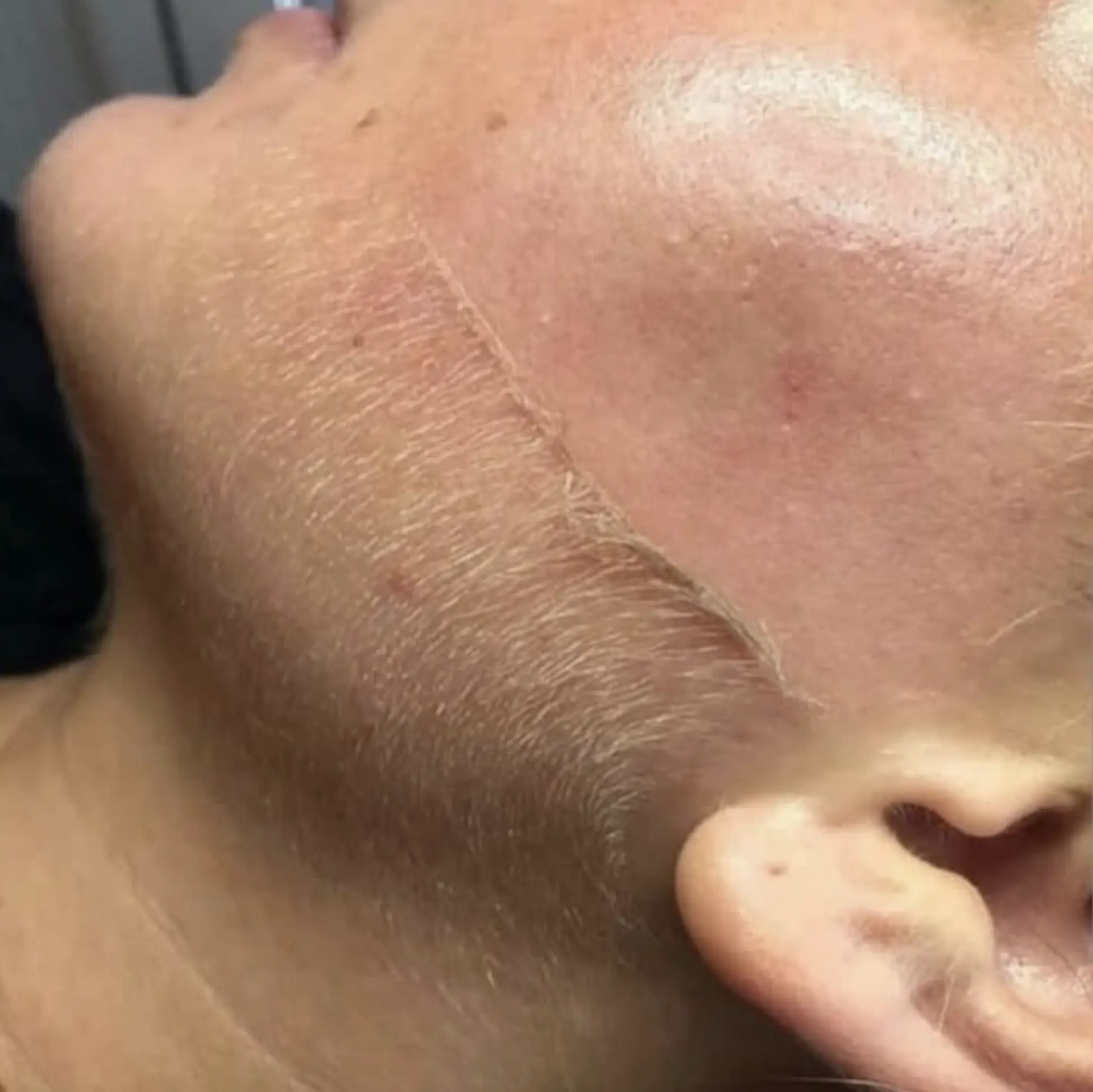 how often exfoliate face